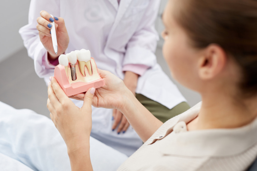 what you need to know about dental implants