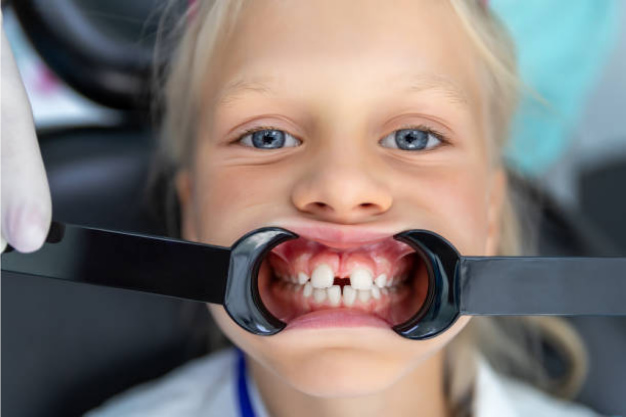 what steps can I take to help prevent a childhood overbite