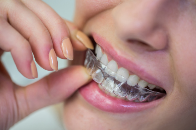 advantages and disadvantages of orthodontics