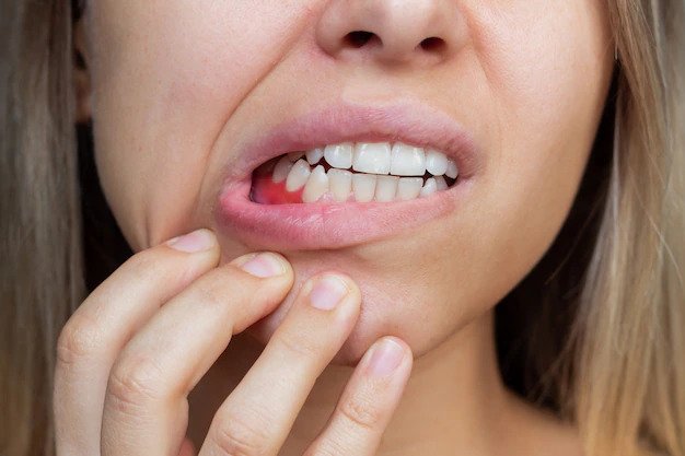 Things to Know About Gum Health