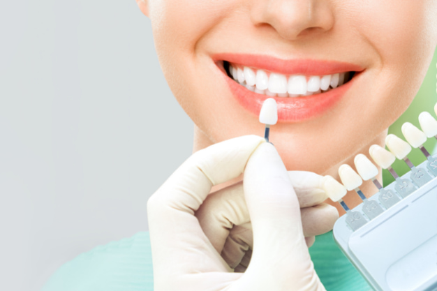 facts everyone should know about teeth whitening