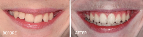 Cosmetic Dentistry