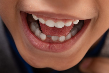signs your child require orthodontic treatment