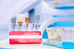 what is involved in getting a dental implant